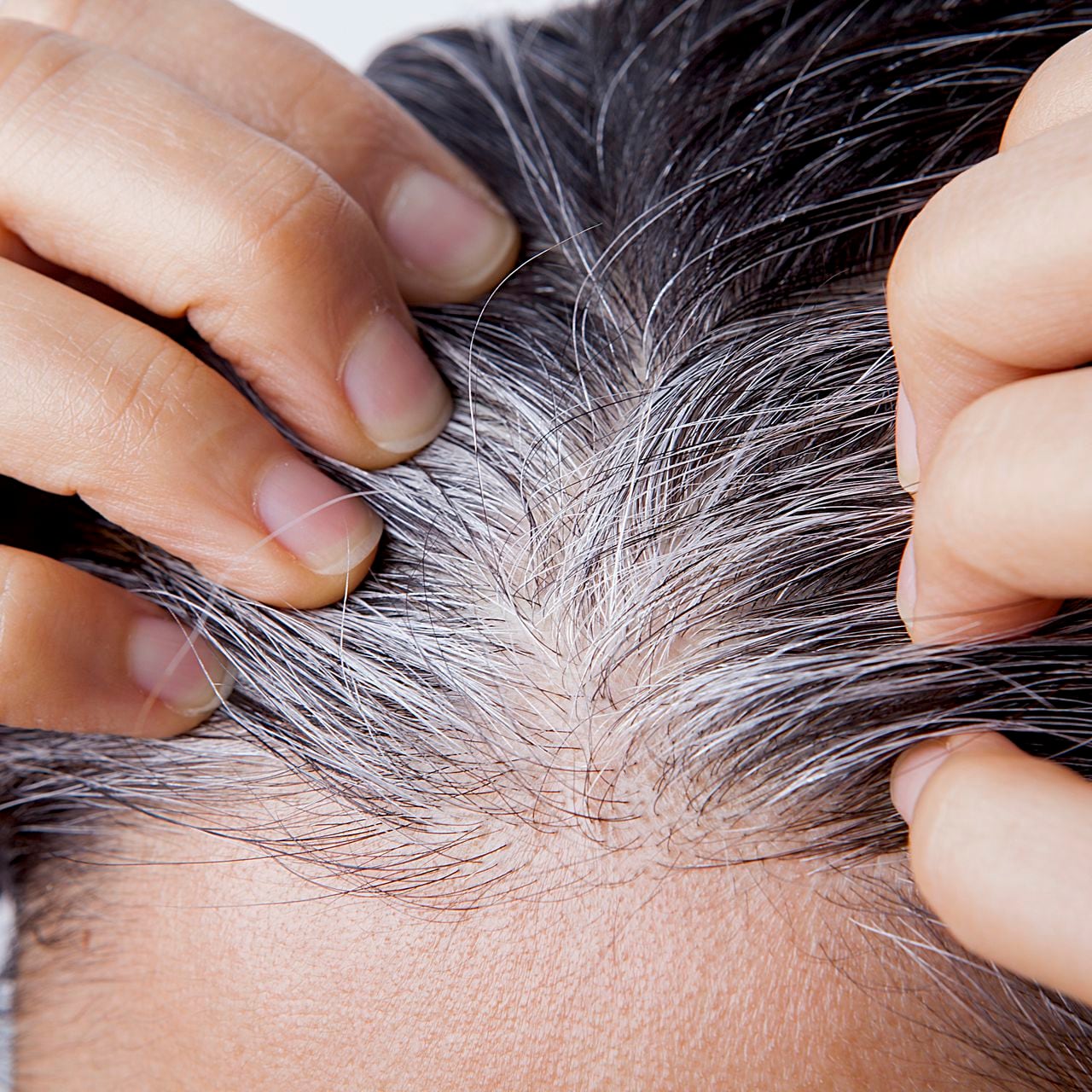 Shampoo de romero y bicarbonato de sodio casero para las canas - 2025